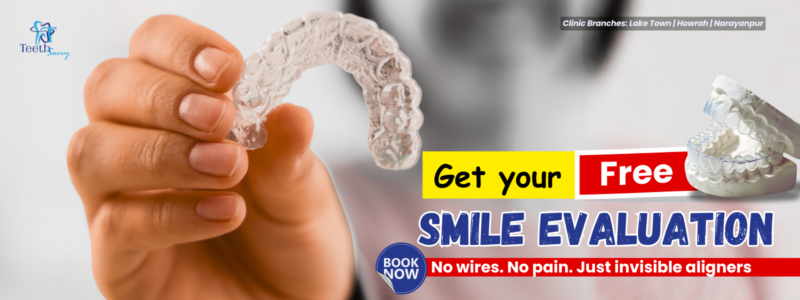 invisible aligners