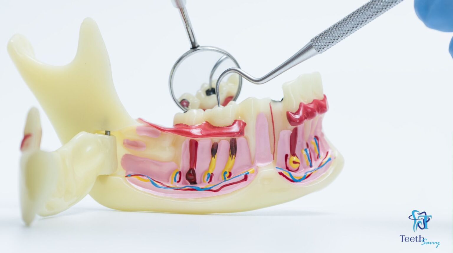 Painless root canal treatment in Howrah at TeethSavvy dental clinic by experienced dentist for severe tooth pain relief