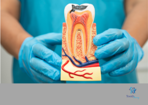 Read more about the article Best Dentist in Laketown for Painless Root Canal Treatment