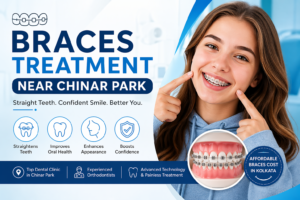 Read more about the article Top Dental Clinic for braces treatment near Chinar Park