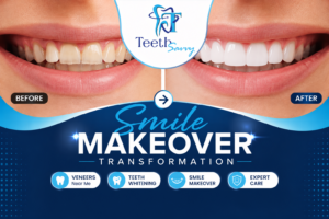 Smile makeover before-and-after transformation showing stained, chipped teeth improved with cosmetic dentistry treatment, featuring a bright, natural-looking smile. Professional cosmetic dentist near me providing veneers, teeth whitening, smile design, and complete smile makeover solutions for enhanced dental aesthetics and confidence.