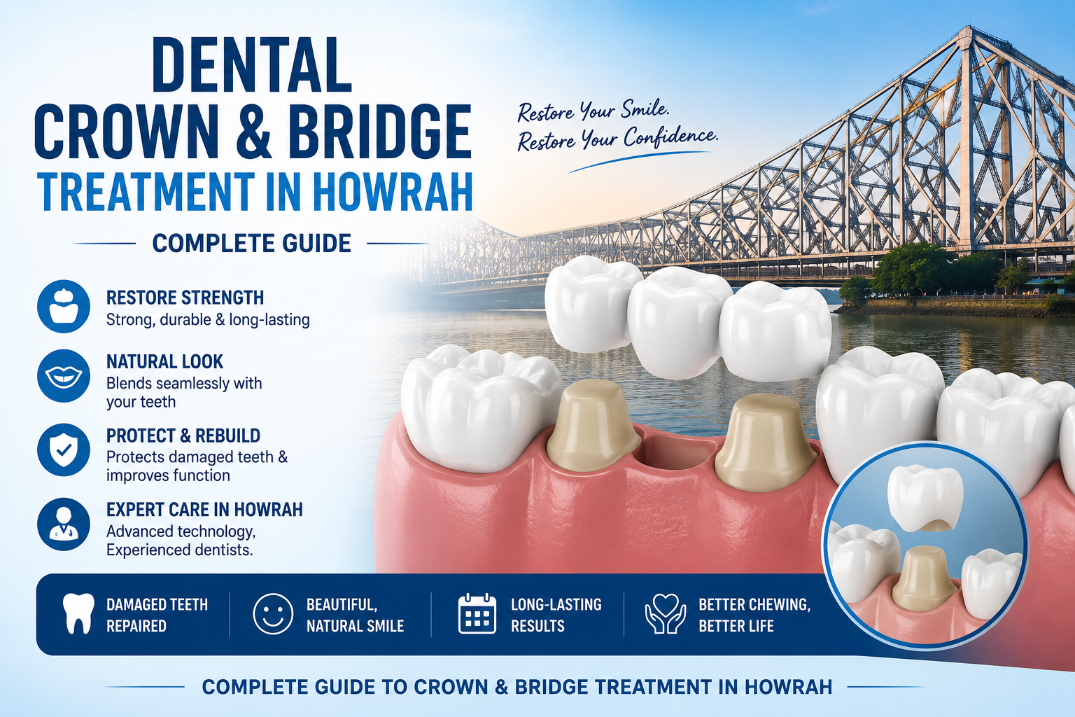 You are currently viewing Dental Crown & Bridge Treatment in Howrah – Complete Guide