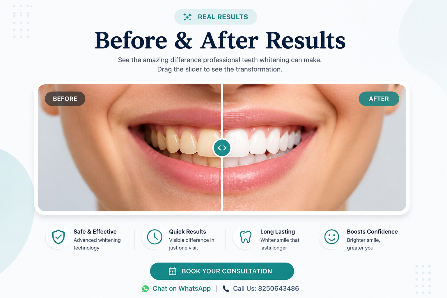 Before and After Professional Teeth Whitening Results