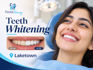 Professional teeth whitening in Laketown at Teeth Savvy dental clinic
