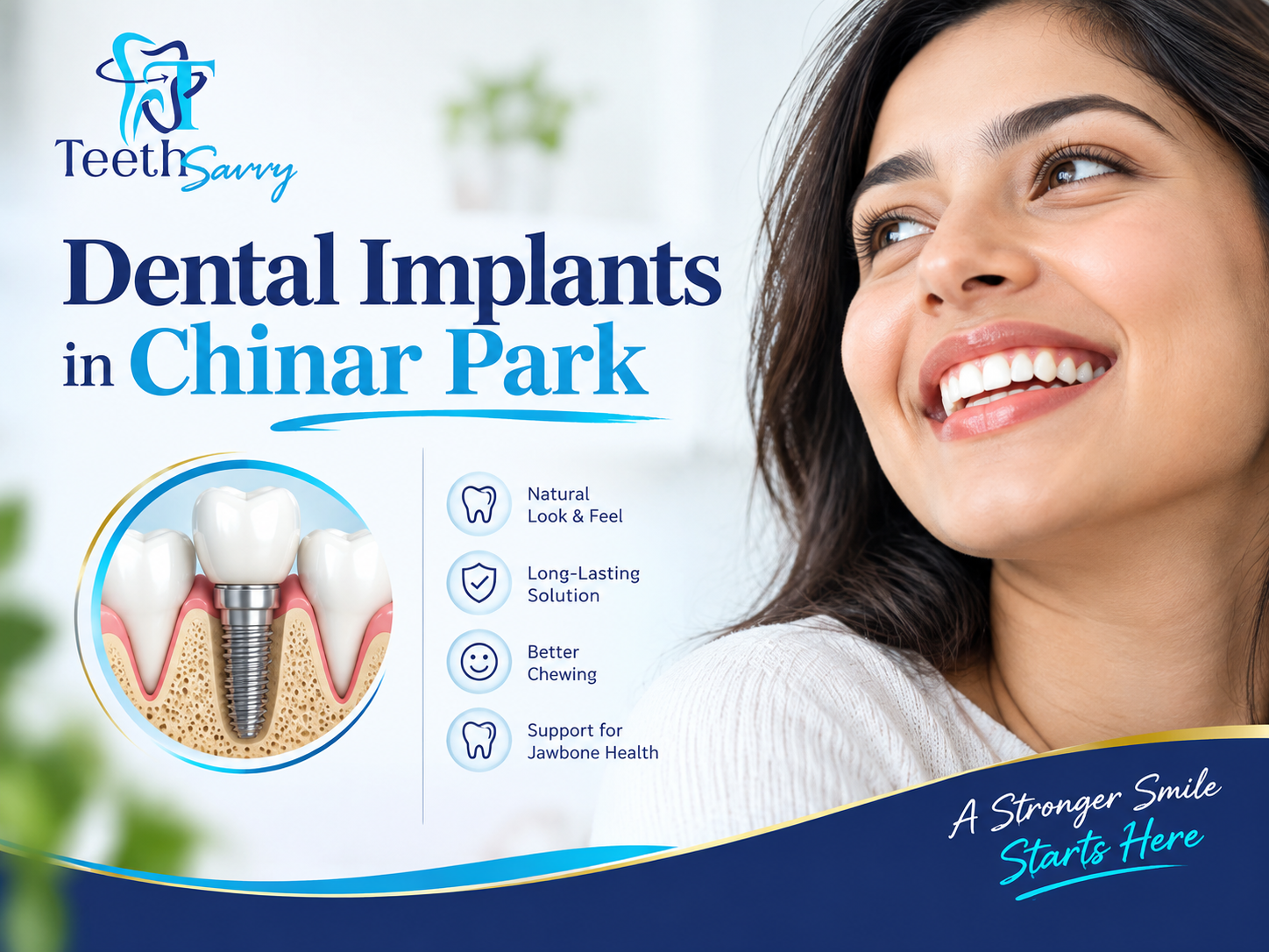 You are currently viewing 5 Amazing Benefits of Dental Implants in Chinar Park for a Healthy, Confident Smile