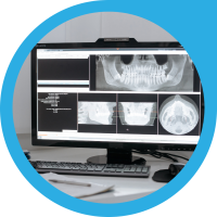Dental X-Rays