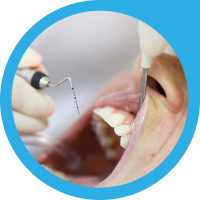 Periodontal Flap Surgery